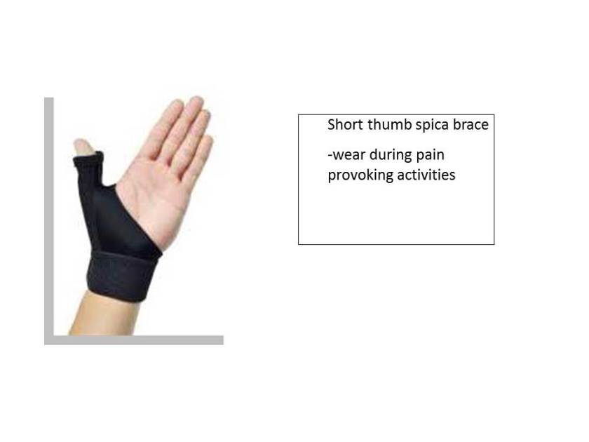 Thumb (First CMC joint) osteoarthritis – Neuromuscular and ...